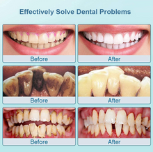 Load image into Gallery viewer, "Arna Lisa" Royal Collection - Home Dental Kit