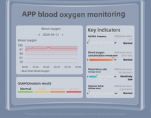 Load image into Gallery viewer, Smart Watch - Touch Screen - Sports - Waterproof - Bluetooth - Medical ECG+PPG (SPECIAL)