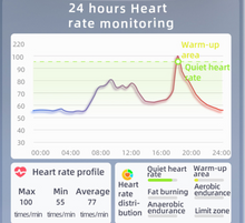 Load image into Gallery viewer, Smart Watch - Touch Screen - Sports - Waterproof - Bluetooth - Medical ECG+PPG (SPECIAL)