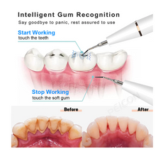 Load image into Gallery viewer, &quot;Arna Lisa&quot; Royal Collection - Home Dental Kit
